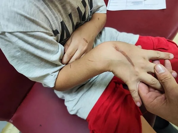 Geçtiğimiz cuma günü çiftin evinden gelen inleme şeklindeki sesleri duyan mahalleli polise ihbarda bulundu. Olay yerine gelen polis ekipleri evdeki Kudret'e camdan ulaştı. Vücudunun çeşitli yerlerinde yanıklar olan çocuk için olay yerine ambulans çağırıldı.